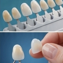Veneers & Crowns